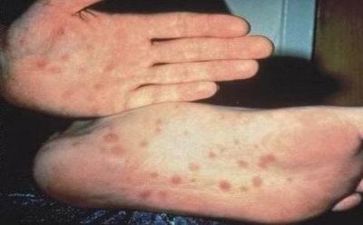 生活组工作总结推荐7篇